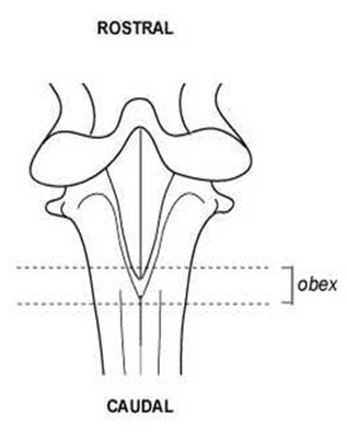 Diagram of the area of tissue (obex) to be targeted.
