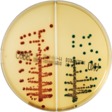 E. coli (burgundy) on CHROMID CARBA SMART agar.